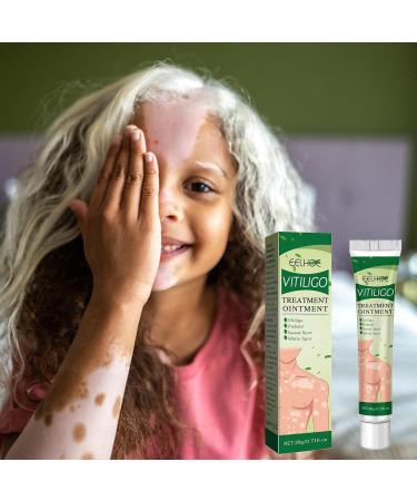  Bexdug Cream | 20 herbal ointments Moisturizing cream for skin leukoplakia white spots on the skin - Buy Online on GoSupps.com