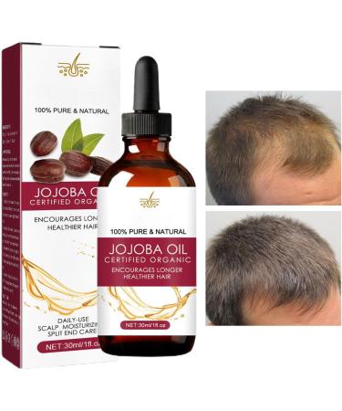 Hair Growth With Scalp Oil Jojoba Hair Density Oil - For Hair Anti- Natural For Hair Regrowth For Women And Men With Or - Buy Online on GoSupps.com