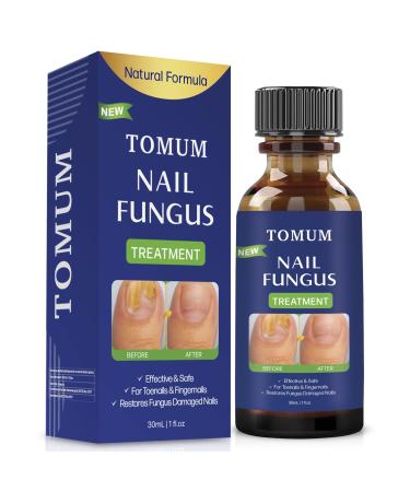 Toenail fungus treatment Nail Fungus Treatment for Toenail Toe Nail Fungus Treatment Extra Strength Effective Fingernail and Toenail Fungus Killer Nail Repair Solution Restoring Healthy Nails yellow