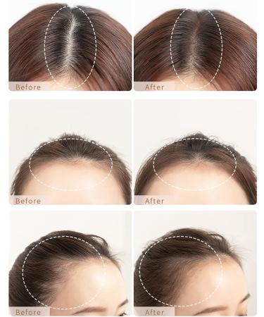 Hair Powder - Hairline Shadow Powder - Hair Root Touch Up Hair Colour Spray - Hair Thickening Products for Women Men - Waterproof Long-lasting Bodify Hairline Fibres Temporary Hair Filler (BLACK) - Buy Online on GoSupps.com