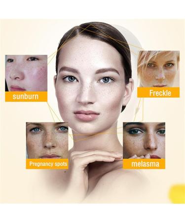 Dark Spot Remover for Face and Body - Sun Spots and Melasma Freckle Remover - Age Spot Remover for Face - Sunspots & Melasma Cream with Niacinamide - Hyperpigmentation Treatment Spot Treatment - Buy Online on GoSupps.com