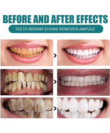 Ampoule Toothpaste Essence Ampoule Toothpaste Teeth Whitening Ampoule Toothpaste Tartar Plaque Toothpaste Tartar and Plaque Removal - Buy Online on GoSupps.com