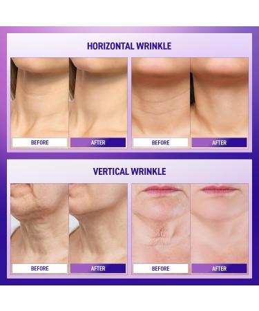 Ashania Neck Firming Cream: Neck Creams for Tightening and Firming - Korean Skin Care Tighten and Lift Neck Cream Advanced Fomula 1.7 Fl Oz - Buy Online on GoSupps.com