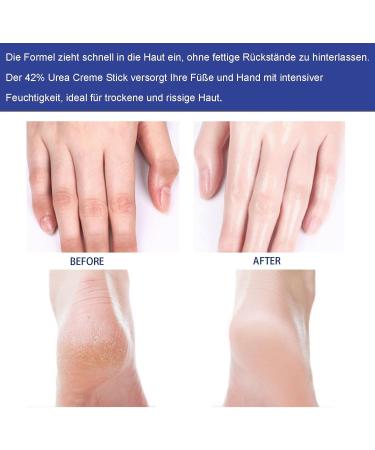  MEITREND Moisturizing and anti-callus foot cream 42% urea cream stick foot cream for very dry feet moisturizing and anti-callus cream with urea - Buy Online on GoSupps.com