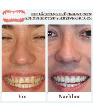 Shop Spokki 4 Pair Fake Teeth | Cosmetic Tooth Covers & Temporary Dentures for Men & Women - International Shipping Available - Buy Online on GoSupps.com