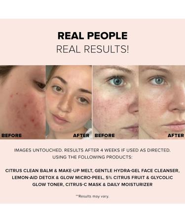 Nudestix Nude Basics Kit 2-Piece Vegan Skincare Set with Gentle Hydra-Gel Cleanser & Citrus-C Daily Moisturizer | Clean Multi-Tasking Essentials for Glowing Skin | Travel-Friendly Starter Kit - Buy Online on GoSupps.com