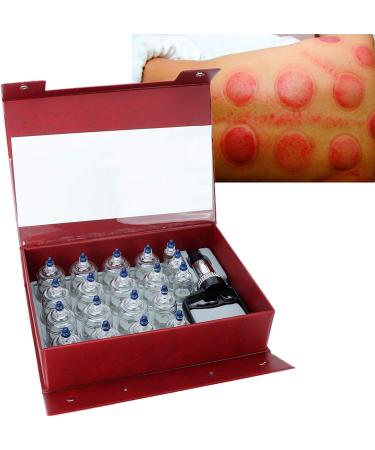 FaceUUUUR Cupping Set with Pump - 19-Piece Chinese Acupuncture Therapy Kit for Home Hijama Muscle & Joint Relief - Buy Online on GoSupps.com