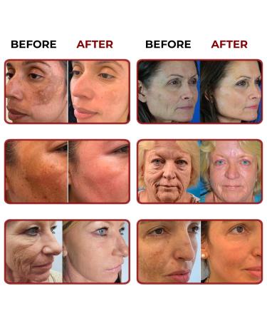 ABERA Saffron Serum For Melasma Treatment Renewing for Face Anti-Aging Treatment for Fine Lines & Wrinkles High Potency Saffron Extract Hydrating Serum Dark Spot Remover (2 BOXES) 1.01 Fl Oz (Pack of 2) - Buy Online on GoSupps.com