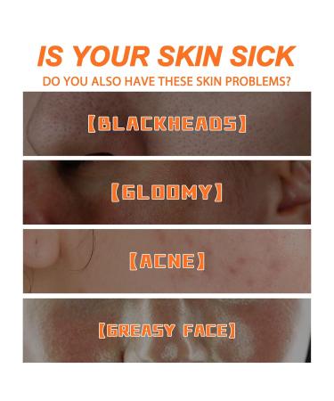 KVVS Carrot Extract Bubble Facial Mask - Blackhead Removal and Deep Cleaning for All Skin Types - Buy Online on GoSupps.com