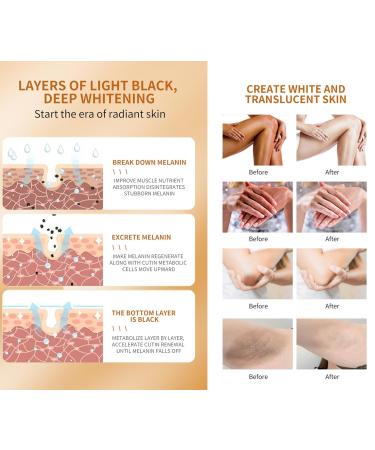 Skin Whitening Cream | Armpit & Underarm Lightening | Dark Spot Corrector for Body | 2oz Intimate Area Bleaching Solution - Buy Online on GoSupps.com