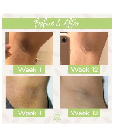 Amaira SOS Intensive Skin Lightening Cream - Natural Brightening & Dark Spot Remover for Face Body Underarms Knees & Elbows (1.7 fl oz) - Shop Internationally - Buy Online on GoSupps.com