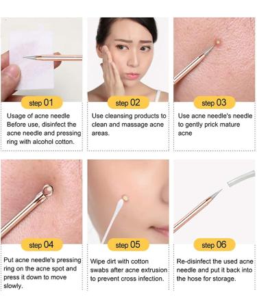 Blackhead Remover Pimple Popper Tool Kit - Professional Acne Extractor Set for Face & Nose - Blemish Whitehead Extraction Tools in Rose Gold Case - Buy Online on GoSupps.com