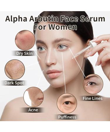 Alpha Arbutin Face Serum - 30ML Anti-Aging & Hydrating Serum for Acne Dark Spots & Fine Lines - 2% HA for Women - Buy Online on GoSupps.com
