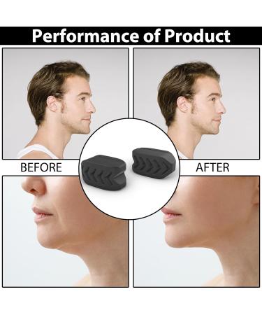 Buy Jawline Exerciser for a Defined Jawline | Shipping Worldwide - Buy Online on GoSupps.com