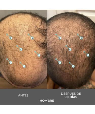  DS Laboratories DS Laboratories Revita Extra Strength Hair Density Shampoo | Anti-Hair Loss Shampoo for Men and Women | With Nanoxidil DHT Blocker Stimulates Follicles Strengthens and Increases Density - Buy Online on GoSupps.com