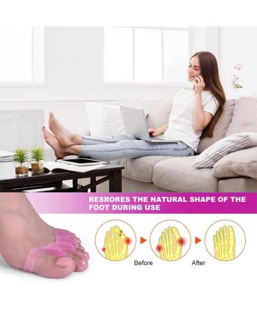 Gel Toe Spacers (2 Pair) - Bunion Corrector for Women Men - Toe Separator & Straightener - Pink - Buy Online on GoSupps.com