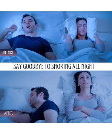 Jolatte 6 Anti Snoring Stopper Set - Chin Strap, Magnetic Nose Clip for Snore Relief - Effective Snoring Solution - Anti Snore Devices - Buy Online on GoSupps.com