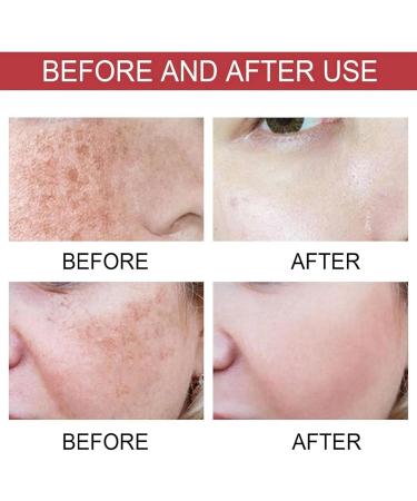 Correcting Face Serum Spot Remover For Face Color Correcting Serum Brightening Serum Face Serums Moisturiser Face Whitening Serum Anti Aging Serum For Face Skincare - Buy Online on GoSupps.com