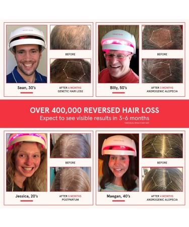 iRestore Stronger Strands Bundle: Biotin Gummies + Essential Hair Device - Buy Online on GoSupps.com