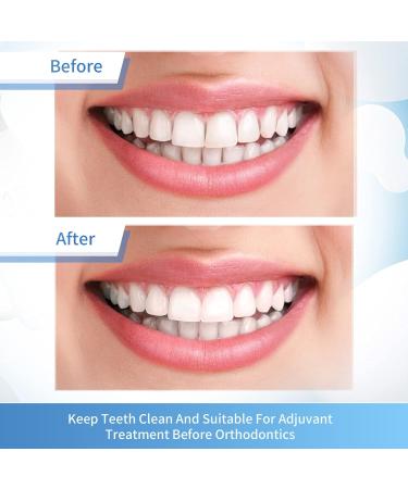 Dental Polishing Strips 4mm x 6M Fine (Blue) - 1 Count | Teeth Abrasive & Finishing Strips - Buy Online on GoSupps.com