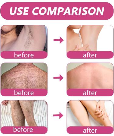 Cr me D pilatoire Douce For Femmes - Aisselles Et Corps Entier Formule Hydratante Non Irritante Et Action Rapide For Une Peau Lisse Et Soyeuse(3PCS) - Buy Online on GoSupps.com