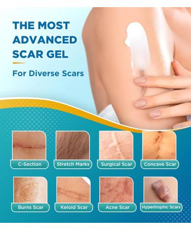 2X Potency Scar Cream - Rapid Deep Repair for C-Section Acne Keloid Burn & Stretch Marks | Silicone Gel Scar Treatment | 1.76oz - Fast International Shipping - Buy Online on GoSupps.com