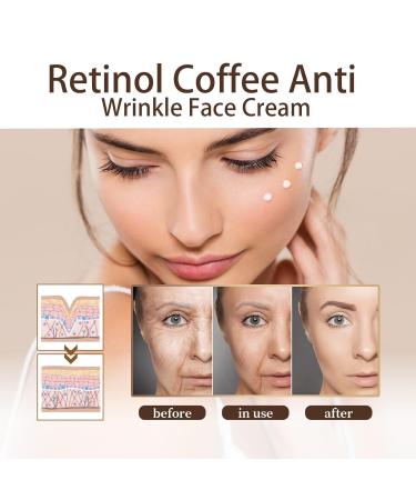 Moisturizing Retinol & Caffeine Eye Cream Set | Anti-Aging Dark Circle Brightener (3 PCs) - Buy Online on GoSupps.com