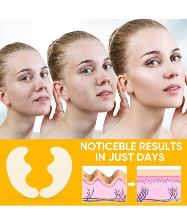 Parrots Treasure Wrinkle Patches - Anti-Wrinkle Facial Patches for Smile Lines - Reduce Fine Wrinkles - Tightening Face Tape for Wrinkles Remover - Buy Online on GoSupps.com