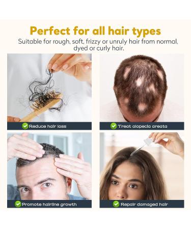 SEMOPHI 5% Minoxidil Hair Growth Oil| Biotin Serum for Hair Loss Treatment | Promotes Thicker, Longer Hair | 1.7 fl.oz - Buy Online on GoSupps.com