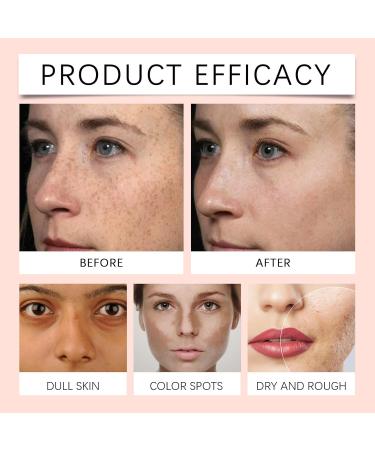Glutathione Serum - Kojic Acid Serum for Skin Lig_htening - Dark Spot Correcting Glow Serum - Vitamin C Serum for Face - Hydrating Serum - Facial Serum for Even Skin Tone Moisturising (30ml) - Buy Online on GoSupps.com