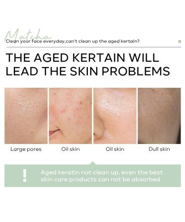 Matcha Peeling Gel - Deep Cleansing Exfoliating Gel for Face & Body | Shrink Pores Hydrate & Improve Skin Tone - 60g - Buy Online on GoSupps.com