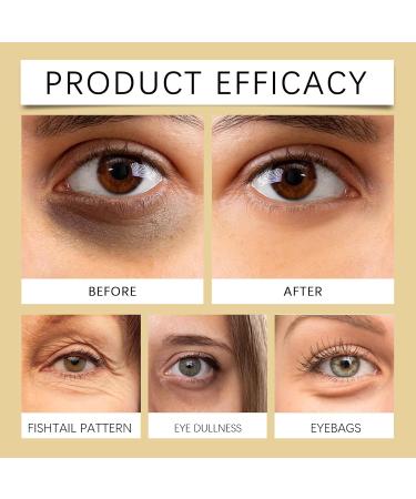 YOENBG Retinol Under Eye Cream Powerful antiaging eye treatment for dark circles bags and fine lines moisturizing and natural eye cream for all skin types 1 - Buy Online on GoSupps.com