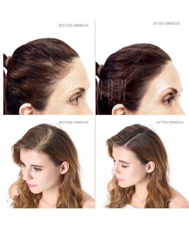 Natural Hair Loss Concealer - Hair Building Fibers for Men and Women 0.87oz (Black) - Buy Online on GoSupps.com