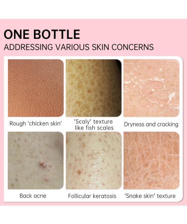 Skin Exfoliating Repair Cream Chicken Skin Care Cream Strawberry Legs Treatment Body Cream Hydrating Moisturising Refreshing Skin Fragrance Repair Body Lotion 50g - Buy Online on GoSupps.com