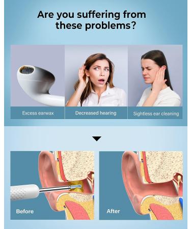 BEBIRD R1 Ear Wax Removal Tool with 1080P Ear Camera - Ear Cleaner Kit for Earwax Removal - Includes 2 Silicone Ear Scoops and 6 LED Light Ear Pick - Buy Online on GoSupps.com