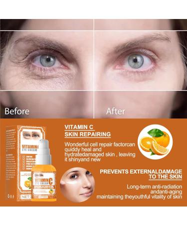 Vitamin C Eye Cream - Anti-Puffiness & Moisturizing Jasmine Ointment | 30ml - Buy Online on GoSupps.com