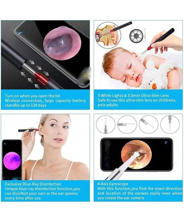 SMSOM Ear Wax Removal Ear Cleaner 1920P HD Wireless Ear Otoscope Earwax Removal Tool Safe Ear Wax Removal Kit for Adults Kids &Pets Black - Buy Online on GoSupps.com
