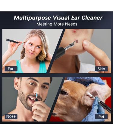 KUIIYER Ear Camera - 1080P WiFi Ear Cleaner Kit for Blackhead & Earwax Removal | Wireless Otoscope for iPhone & Android - Buy Online on GoSupps.com