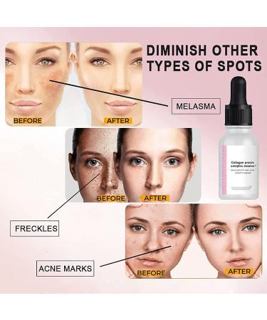 2022 New Blemishskin Corrector Serum Blemish Skin Corrector Serum Luxury 2022 New Sheep Placenta Collagen Serum Luxury Collagen Protein Complex Essence Serum Moisturizing Repair Serum (3PC) - Buy Online on GoSupps.com