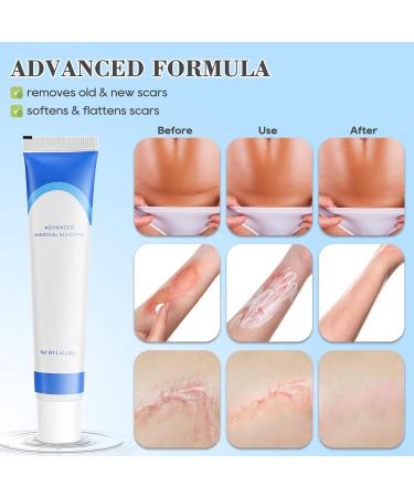 COSMTEK Silicone Scar Gel Cream - Physician Formulated for Keloids, C-Section, Burn, Surgery & Acne - 4cmx3m - Buy Online on GoSupps.com