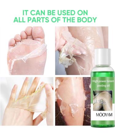 Extra Strong Green Peeling Oil Extra Strong Peeling Oil for Dark Skin Yellow Peeling Oil Extra Strong Peeling Oil Extra Strength Exfoliating Peeling Solution for Hand Feet Dead Skin Remover (2PC) - Buy Online on GoSupps.com