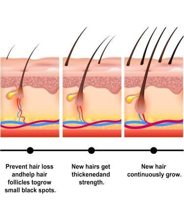 Batana Oil Organic Batana Oil for Healthy Hair Hair Butter with 100% Pure Raw Batana Oil Nourishes Thin Hair Scalp Skin and Loss Hair Growth Fir for All Hair Types (Black-Hair Mask) - Buy Online on GoSupps.com