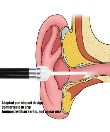 Ear Check Flashlight - LED Ear Pick for Earwax Removal and Hearing Aid Fitting - Buy Online on GoSupps.com