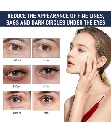 Rapid Reduction Eye Serum Advanced Formula Instant Eye Serum Anti Aging Serum Visibly Reduces Under-eye Bags Nourishing Eye Serum Suitable For All Skin Type (2Pcs) - Buy Online on GoSupps.com