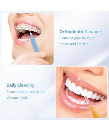 Annhua Interdental Brushes Set - 100 Pieces Tooth Cleaning Tool with Storage Box | Multi-Color Options for Dental Care - Buy Online on GoSupps.com