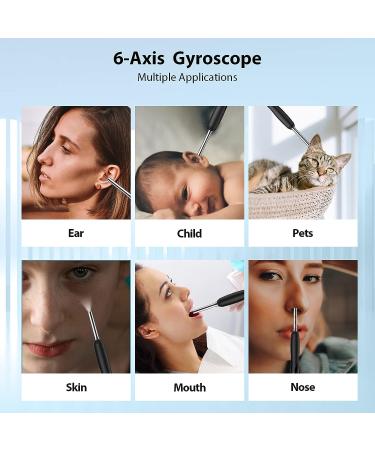 KAIDIFI Ear Wax Removal Camera Kit - 1080P Wireless Otoscope with 6 LED Lights, 360 Wide Angle, 8 Pcs Ear Pick - WiFi Compatible for iOS & Android - Buy Online on GoSupps.com