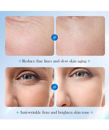 Hyaluronic Acid Serum Microneedling Serum Hyaluronic Acid Anti-Aging Repair Serum Anti -Aging Repair Serum Anti-Wrinkles Essence Anti-Aging Serum for Firming Repairing - Buy Online on GoSupps.com