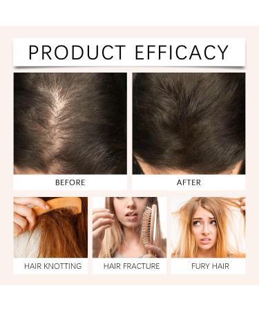  Hengxuan Golabbeauty Scalp Oil 2 Pack - Relieves Scalp Irritation and Dry Scalp - Nourishes and Strengthens Hair Follicles - Buy Online on GoSupps.com