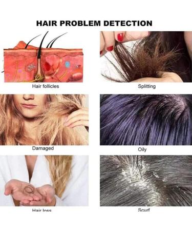 Skin Diagnosis Hair Analyzer 10.1 Inch LCD Screen Digital Charging Type Scalp Hair Follicle Skin Hair Detector Analyser Machine for Home Salon Use - Buy Online on GoSupps.com