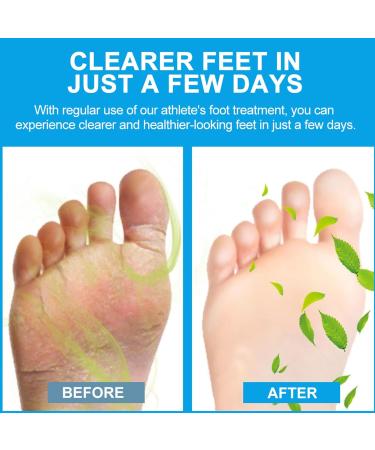 Cr me Antifongique Cr me D odorante Pour Les Pieds Pr vient Les Odeurs Et Apaise Efficacement Les Pieds (20g) - Buy Online on GoSupps.com